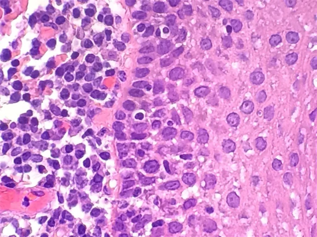 H&E — FFPE tissue section