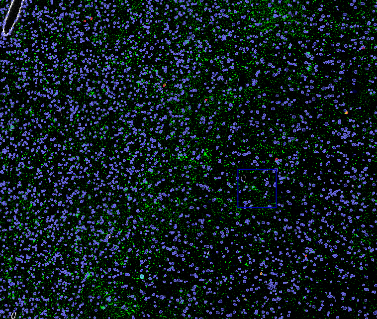 DAPI GFP alignment