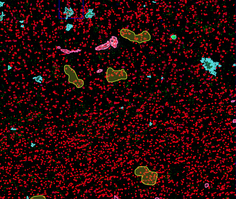 Xenium segmentation